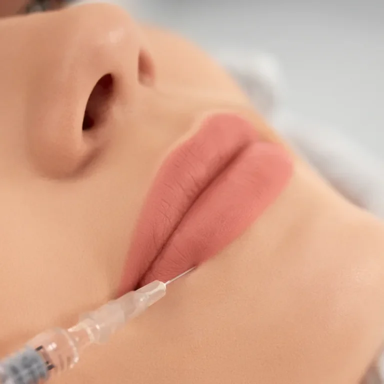 Fillers – Dr. Bee